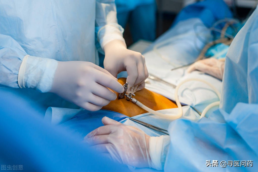 什么怪病？年轻女子每到经期就流鼻血