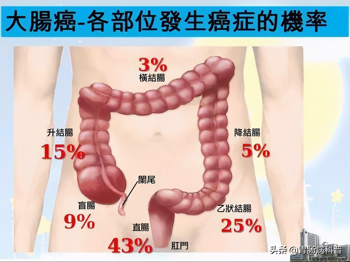 肠镜不是人人都能做——做肠镜，应该注意哪些事情？