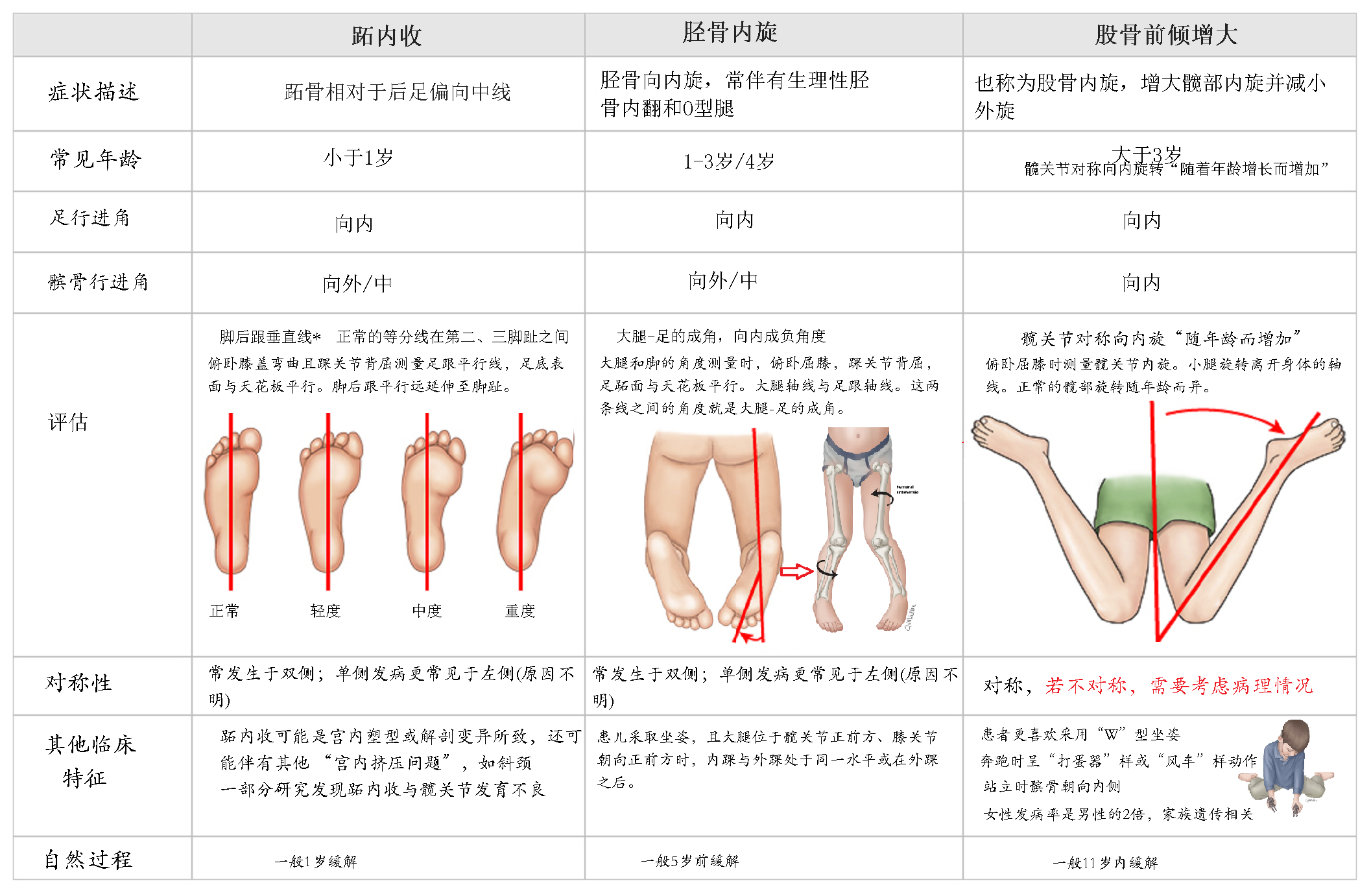 小孩走路内八字，需要担心么？