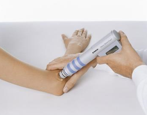 胳膊疼痛咋回事？