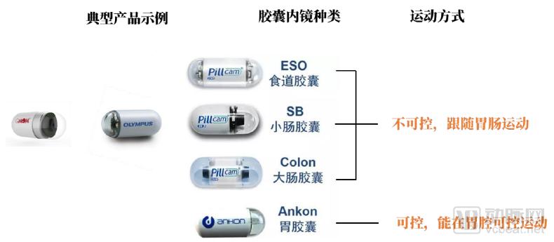 10万胶囊胃镜数据透视中国消化道健康状况，探讨器械智能化价值