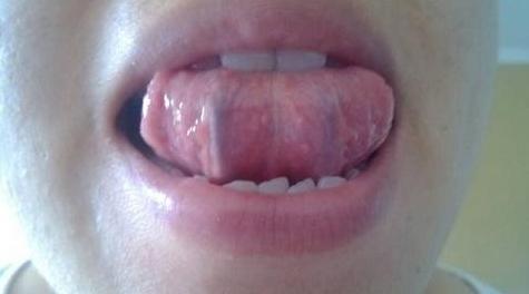 白天调阴阳，晚上安神！教你3个治疗失眠的调理小方