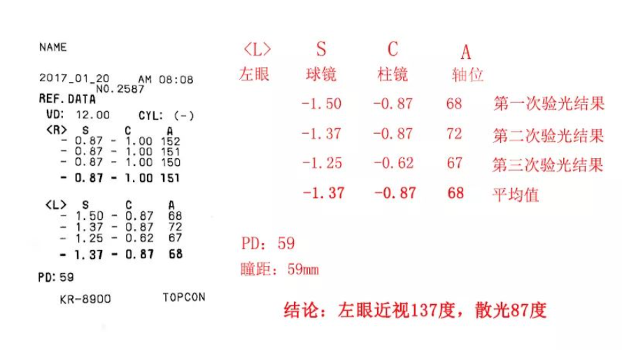 网上眼镜选购指南，验光，镜片镜架选择总攻略