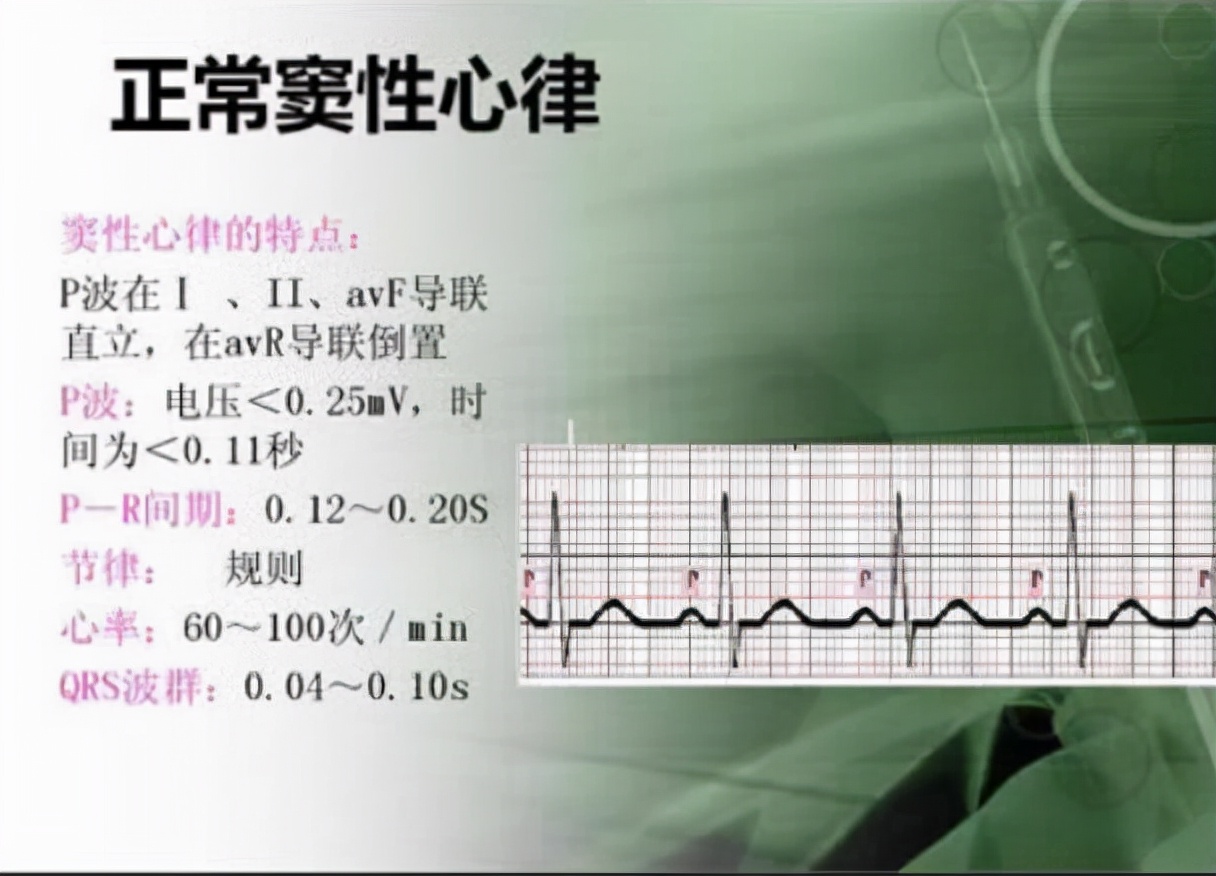 体检时查出这5种病，基本不用治疗，也不要太紧张