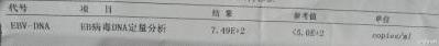 EB病毒感染是什么？严重吗？