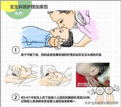 宝宝总是歪头，面向一侧，俗称“歪脖”，听说这叫斜颈，怎么办？