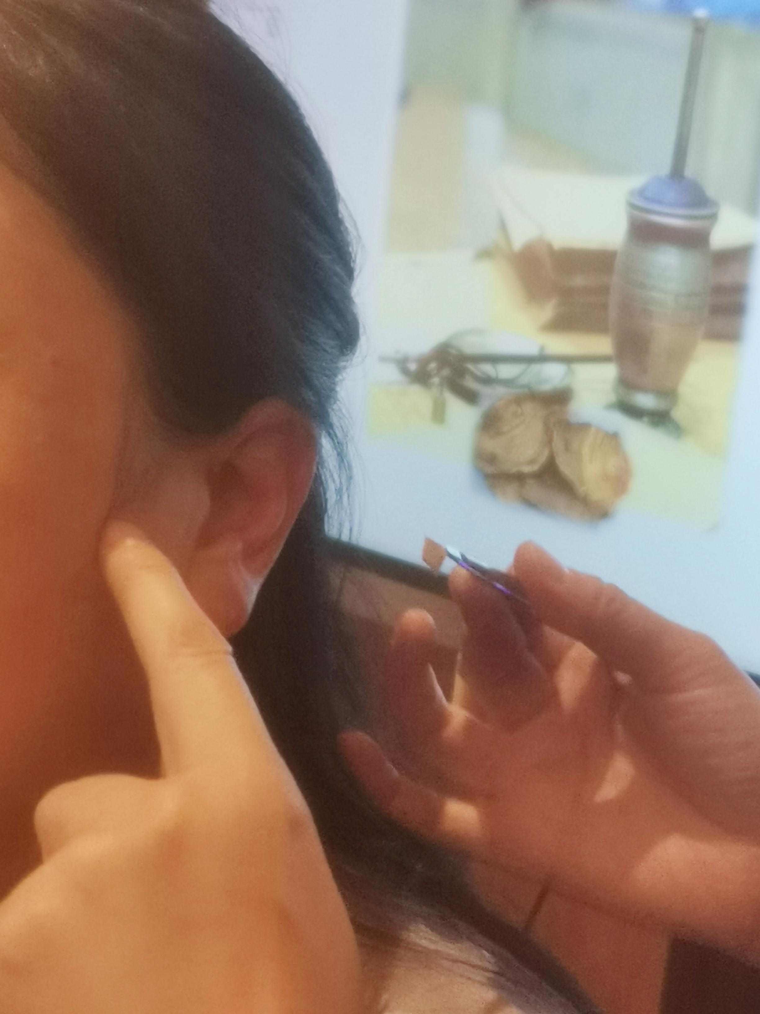 针灸治疗青少年抑郁症，突显中药情志疗法的优势