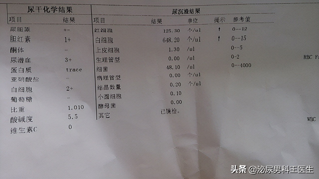 前列腺增生详解！是怎么引发的？有什么表现？如何预防和治疗？