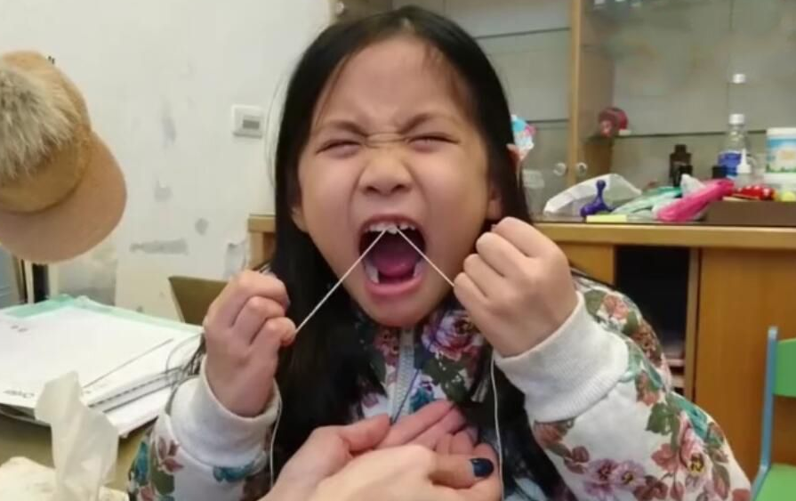 孩子换牙了，掉的“乳牙”怎么处理？方法用对了重要时刻能救命