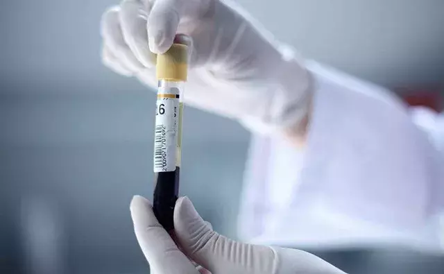 手指疼痛、肿胀变形,不是风湿,而是这个病