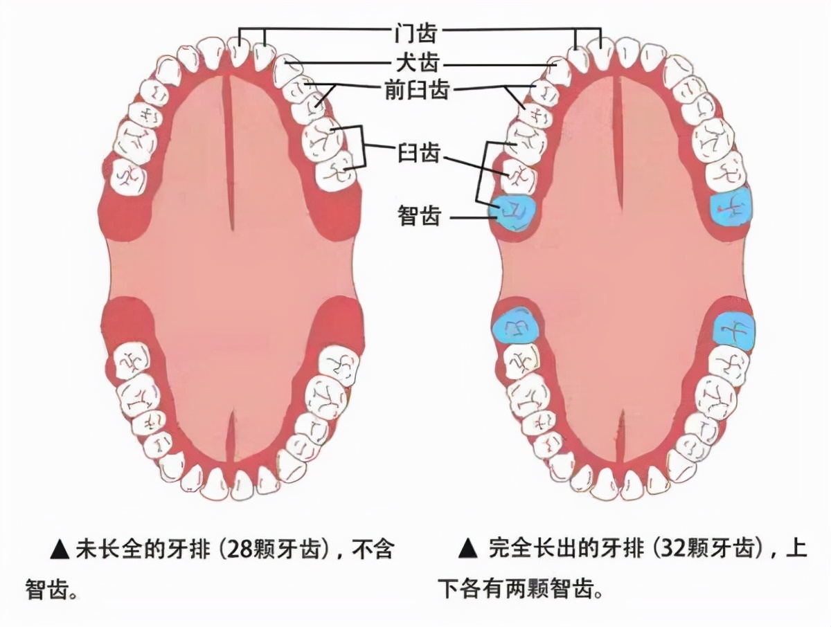 智齿拔不拔，疼不疼，拔牙费用，拔牙后影响，一次性说清楚