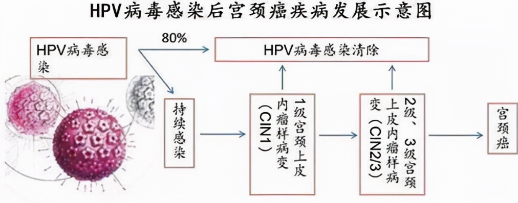 什么是HPV病毒？其病毒类型以及感染途径和病毒特征是什么？
