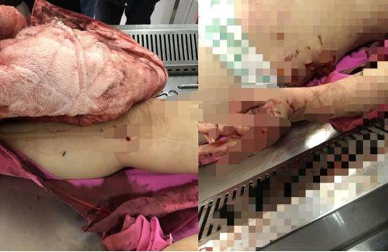 女护士196刀刺死“同性情侣”判死缓？致命“亲密关系”背后的真相公布