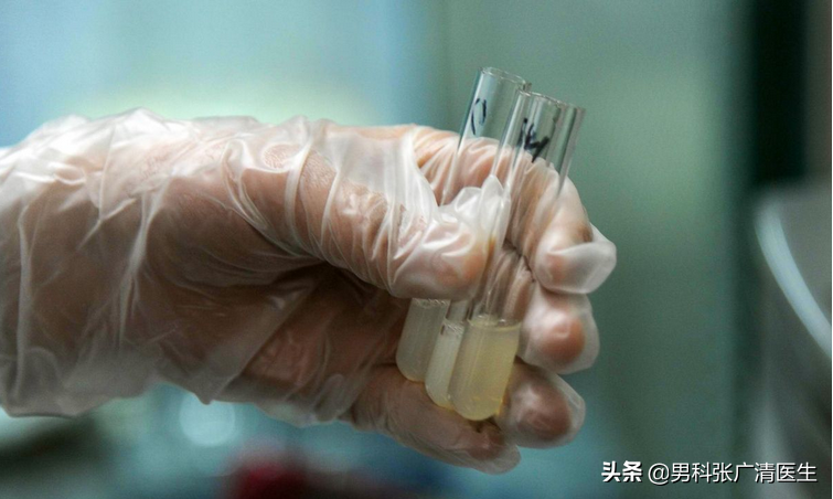 大部分男人不知道，滑精、滴白、脓尿的区别？