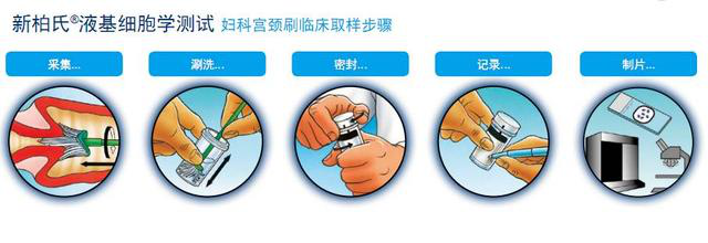 再也不用求人了！手把手教你快速看懂HPV筛查报告