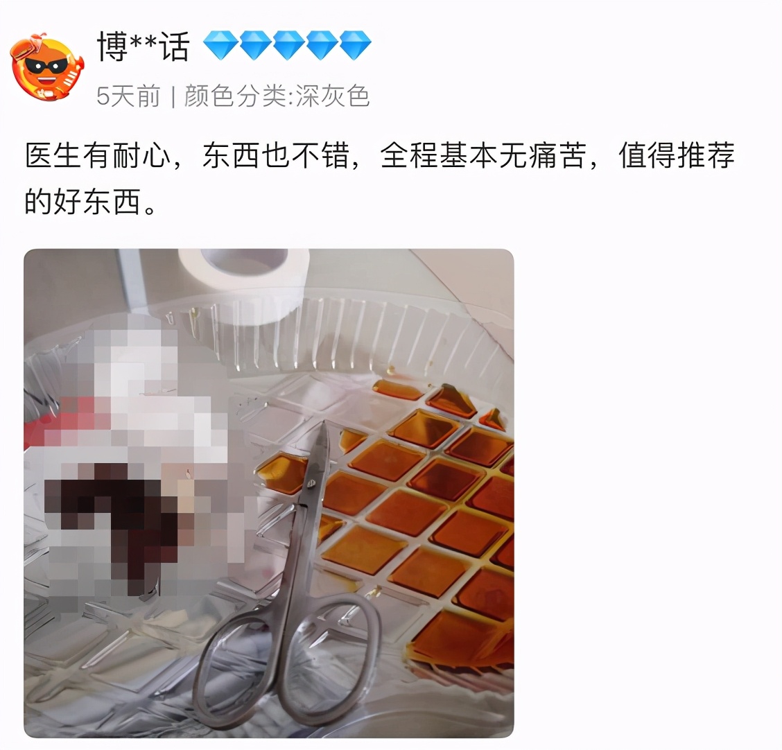 “割包皮”风气兴起，儿科患者排队做手术，医生：割包皮割到想吐