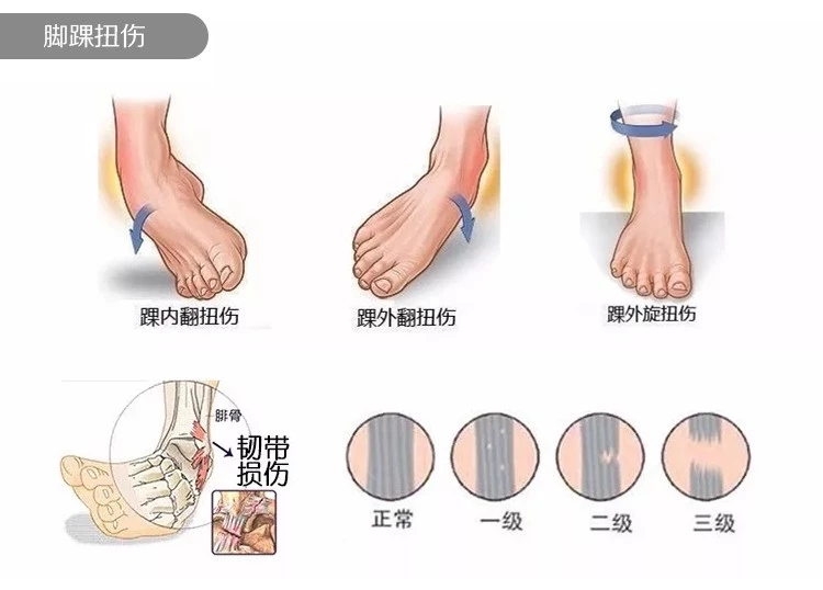 nba球员伤病要经历哪些流程(从东契奇的崴脚，学习NBA级别的康复流程)