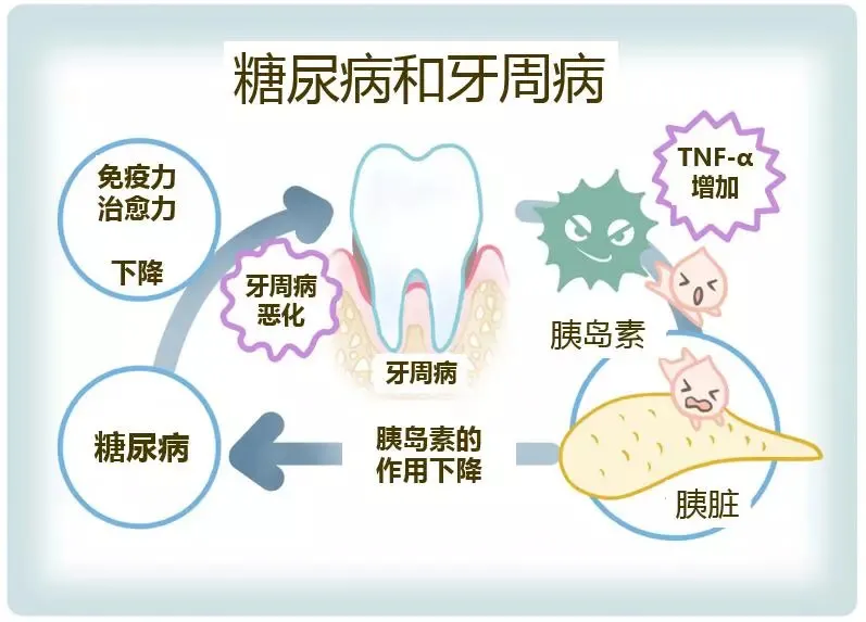 刷牙总出血，很可能是牙齿在喊救命