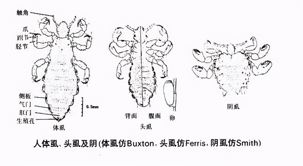 “虱子”与我们共存千万年，为何这几年见不到了？