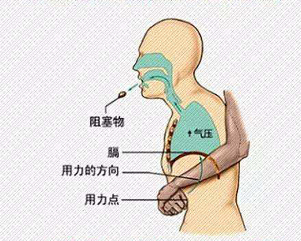 宝宝被食物噎到怎么办？儿科医生教你海姆立克急救法及时挽回生命