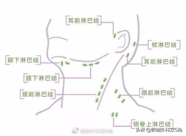 颈部淋巴结肿大怎么办？