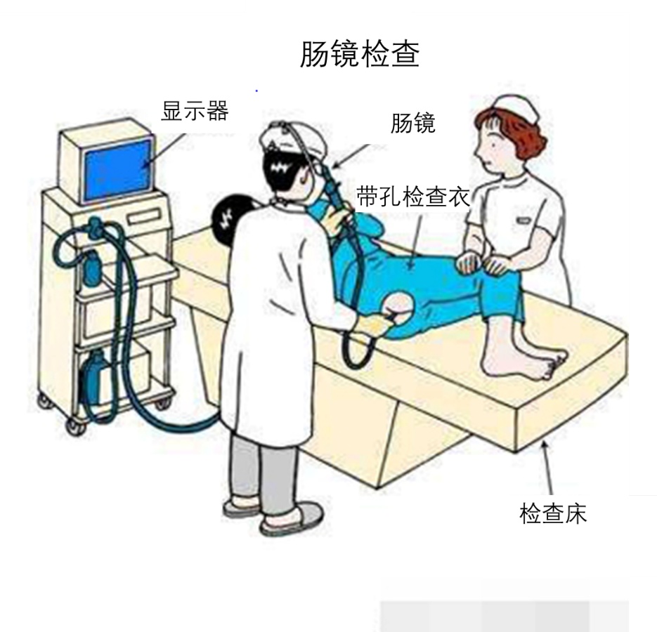 直肠指检和肠镜检查太尴尬？医生告诉你这两个检查的必要性