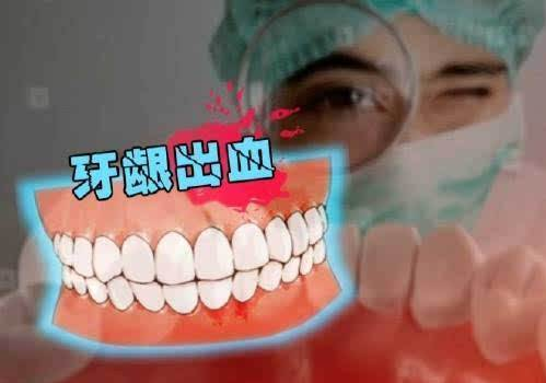 每次刷牙都出血？牙龈出血到底是因为什么？别让小病拖成大病