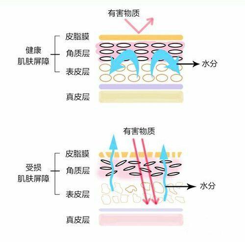 角质层薄怎么修复增厚，改善增厚角质层的办法