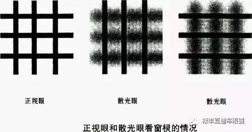 散光看东西的图片(散光真的可以不用太在意吗) - 赤虎壹号