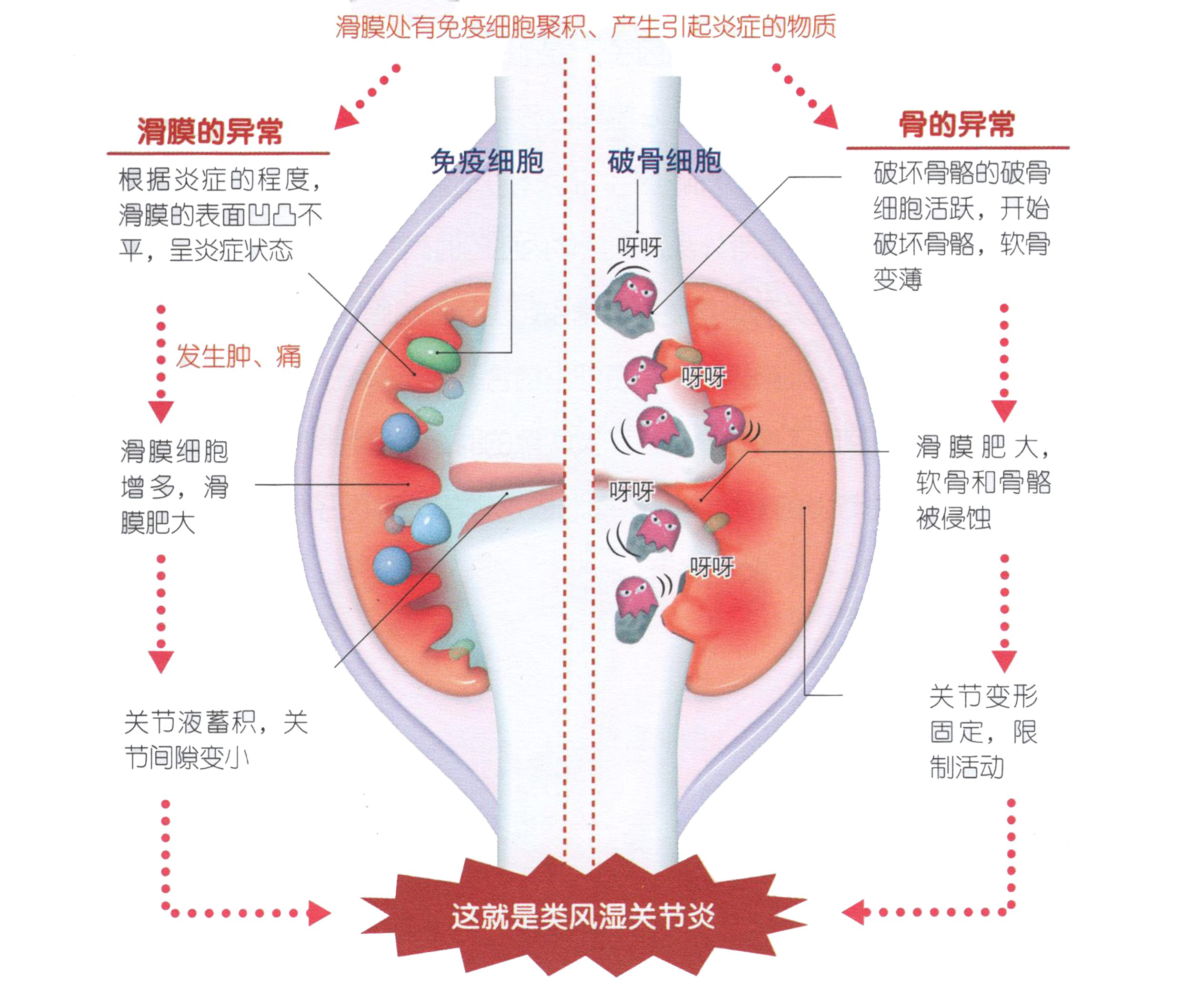 老年人为什么容易膝盖疼？要小心6种疾病，个个危害巨大
