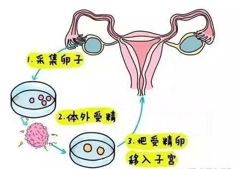 试管婴儿的寿命、智力，和普通孩子一样吗？科学答案在这里