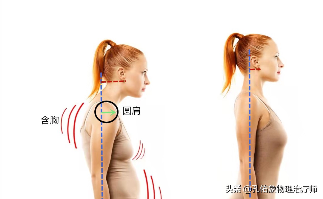 常手麻、手痛，究竟是哪里的问题？不出意外，这5种可能性最大