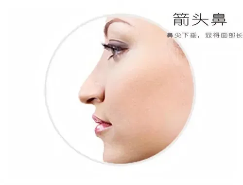 鹰钩鼻特征解析：箭头鼻与鹰钩鼻的区别与性格分析