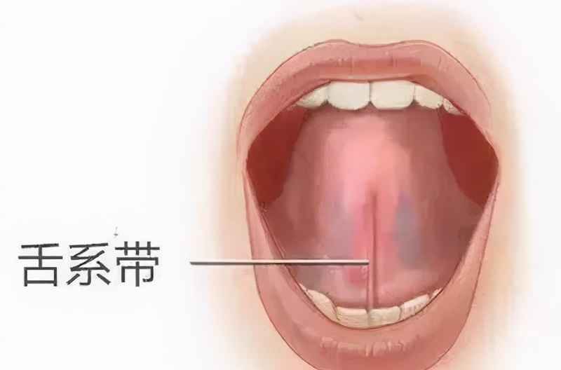 滥用的“剪舌系带”，舌系带到底该不该剪？这一刀孩子挨得很无辜