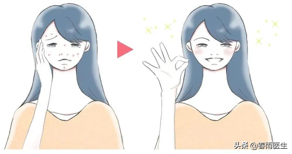网红狂吹的“壬二酸”真是抗痘神器？那它这么多年咋默默无闻