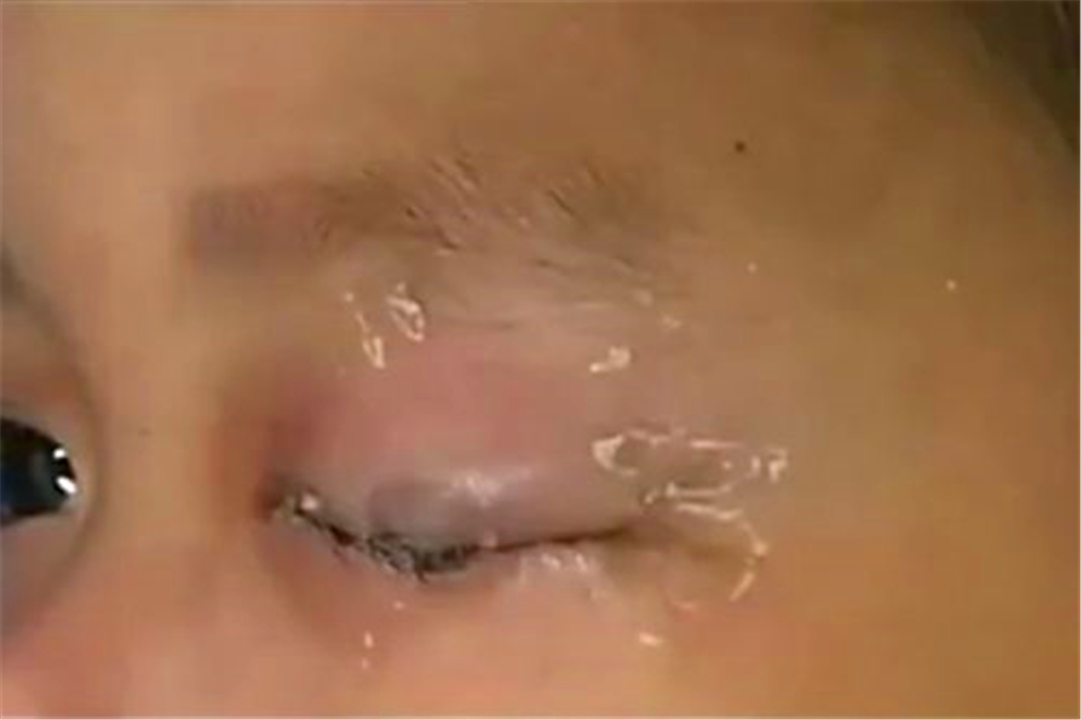 3岁宝宝玩502胶水涂满手，妈妈急中生智的做法，医生竖起大