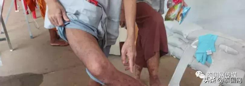 泰国地狱酷刑戒毒所：进来的人，出去绝对无毒瘾，但不一定还活着