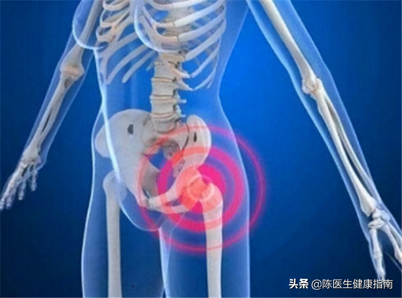 维生素D3、骨化三醇、阿尔法骨化醇，区别在哪里？到底该怎么选？