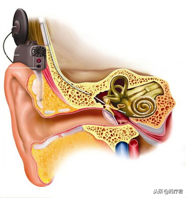 进入中耳,引起鼓膜振动并带动鼓膜后的锤骨,砧骨,镫骨三块听小骨连动