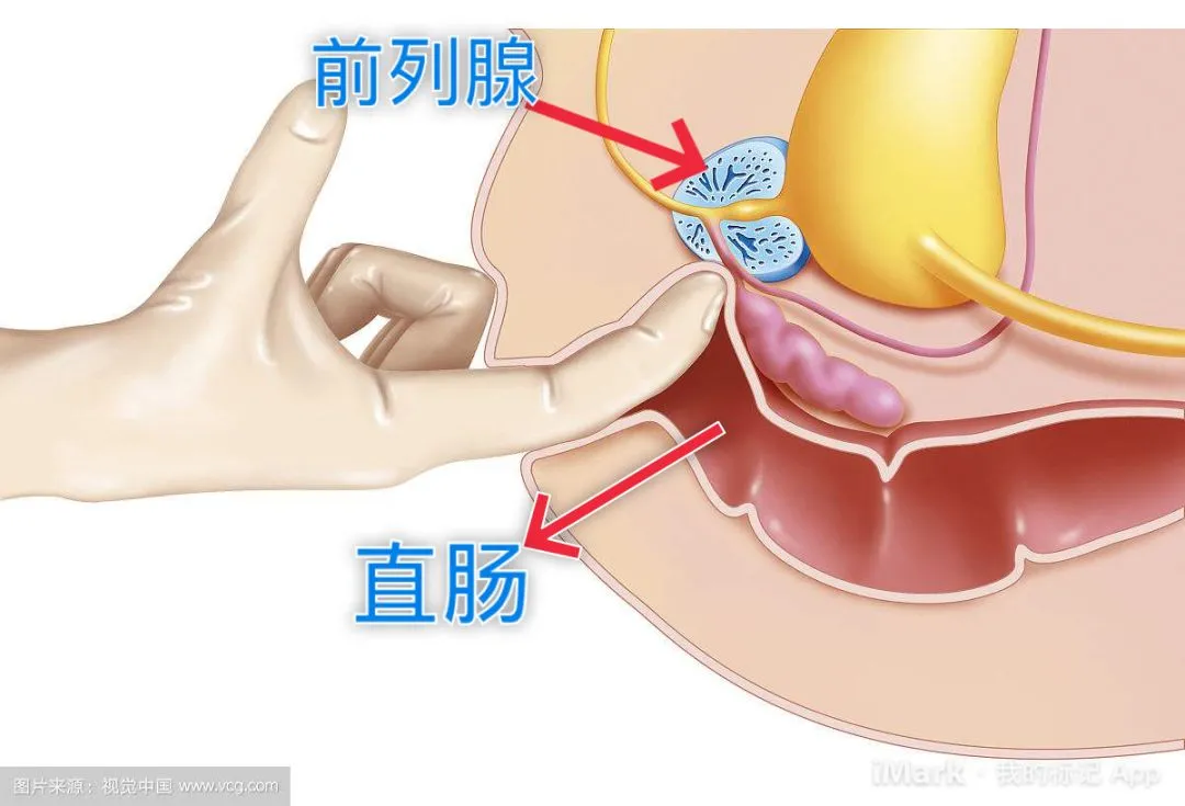 得了前列腺炎會有哪些症狀?怎樣進行調理改善?