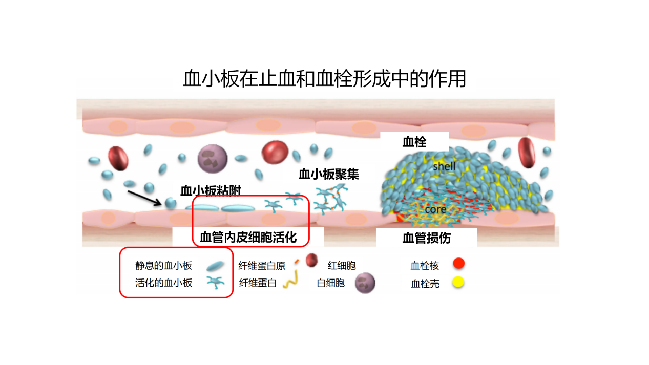 关注血小板的正常值？先看看血小板与血栓的关系！赶紧收藏