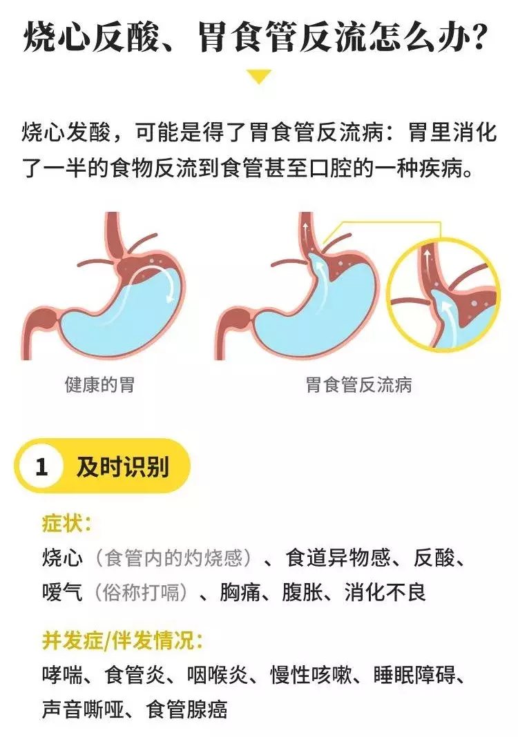 胃里经常反酸怎么办?可以试一试这些办法