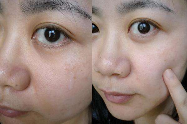 美白是用"sk2小灯泡"还是"olay小白瓶",皮肤色差,真的大