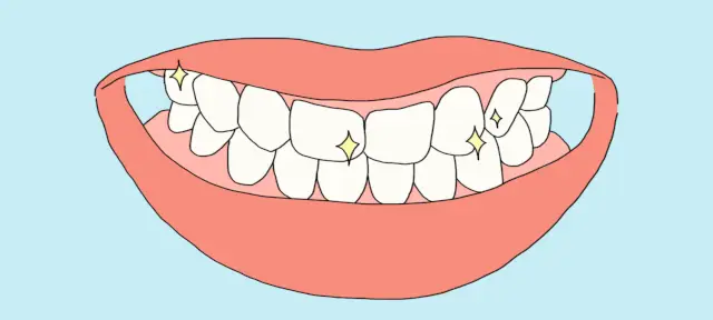 种植牙一颗价格（5000一颗的和15000的有什么区别）