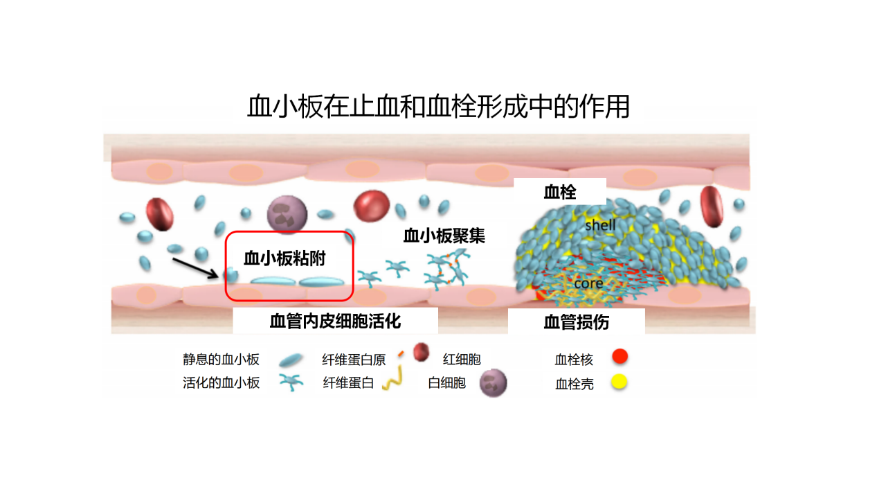 关注血小板的正常值？先看看血小板与血栓的关系！赶紧收藏