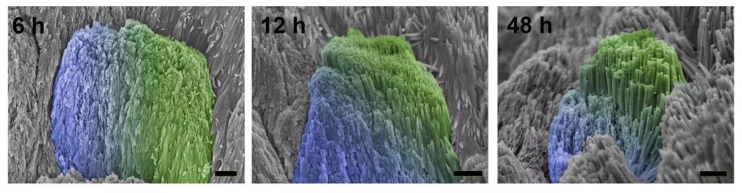 浙大最新黑科技！只要两滴药水，“补牙”不再是难事！