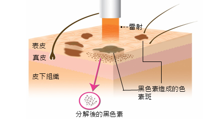 角质层薄怎么修复增厚，改善增厚角质层的办法