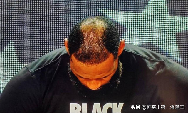 为什么许多nba 球星都秃顶(比普通人都要强壮，为何妖刀、杜兰特和詹姆斯都会早早谢顶？)