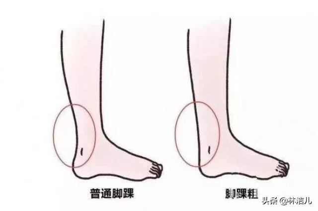 而上面提到的那些"腿精们",在脚踝的纤细程度上也是碾压一般的存在.