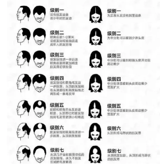 “秃如其来”背后,雍禾医疗IPO引发行业混战?